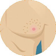 Scaliness, ulceration or retraction