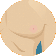 The nipple beginning to turn on itself